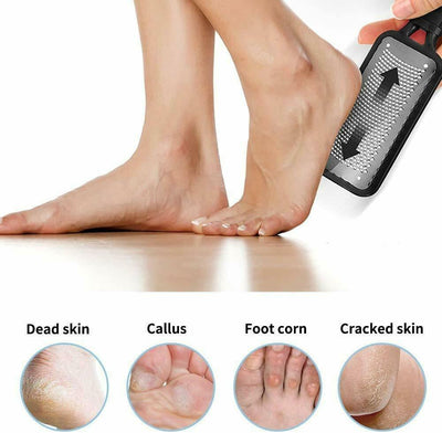 Professional Foot Callus Remover File Rasp Scraper Cracked Pedicure Rough Tool - My Tech Addict